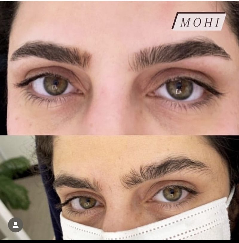 ابرو تخصصی