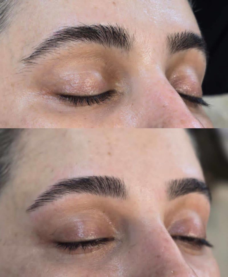 اصلاح ابروی تخصصی و ترمیمی