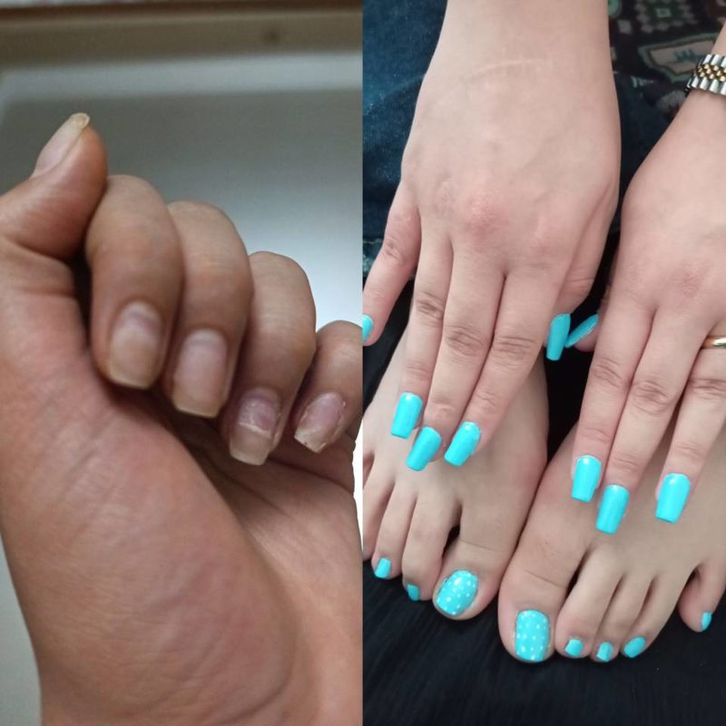 💙