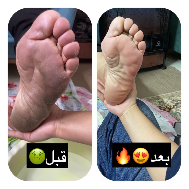 پا قلب دومم بدن هست پس مراقبش باش